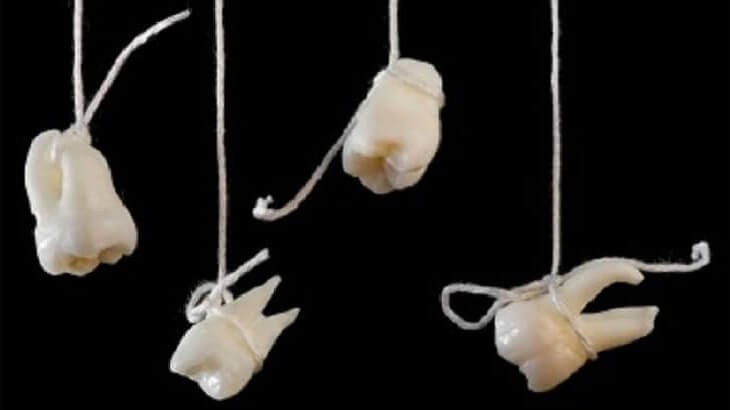 تفسير حلم "تساقط الأسنان"