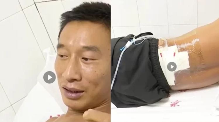 نجاة رجل صينى أصابه البرق مرتين فى 5 دقائق