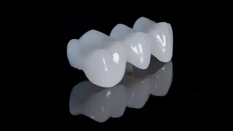 تفسير حلم سقوط ثلاث أسنان في المنام - لابن سيرين