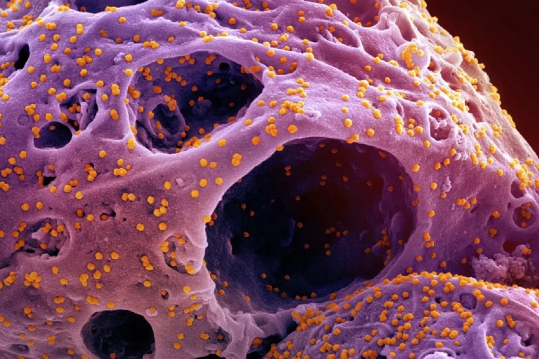 فيروسات الزومبي.. وباء مدفون تحت الجليد منذ آلاف السنين