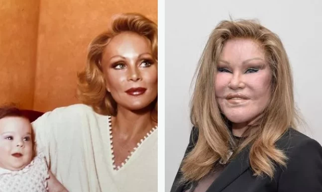 المرأة القطة تتصدر تريندات جوجل بعد وفاتها