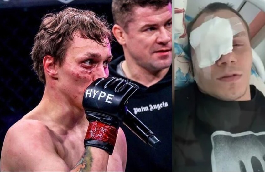 حادثة صادمة.. مقاتل MMA يفقد عينه في عراك مع فتاة
