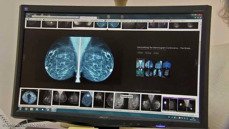 للمرة الأولى.. أول انتصار ضد سرطان الثدي