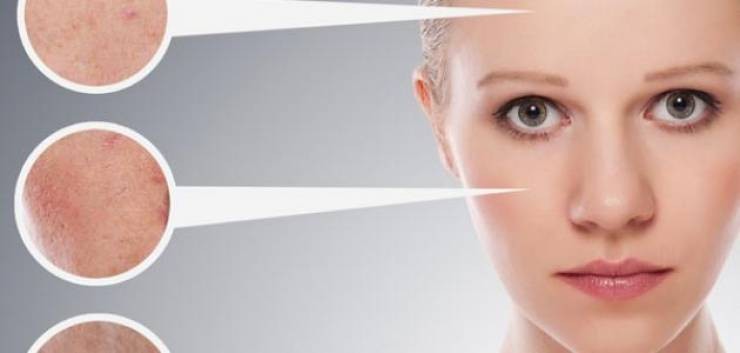 مفاجأة .. اتبعي هذه الخطوات البسيطة وستتخلص بشرتك من عيوبها.