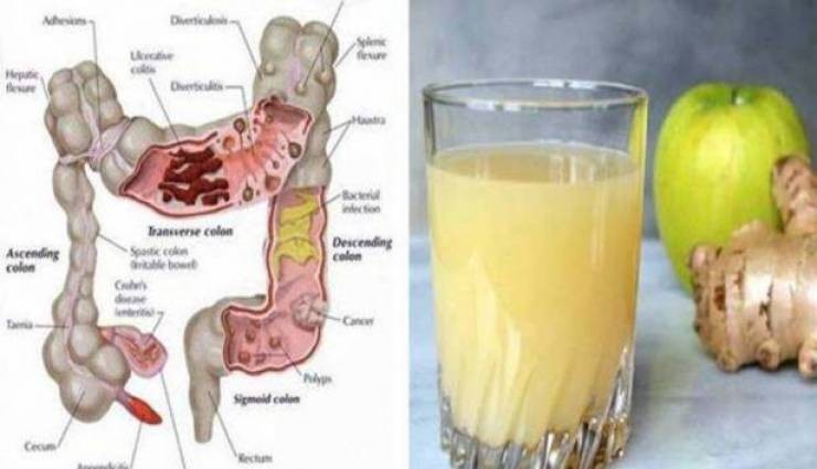 حضّروا هذه الخلطة بـ5 دقائق.. وتخلّصوا من السموم في جسمكم