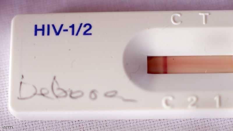 خرافات يصدقها كثيرون عن "الإيدز"