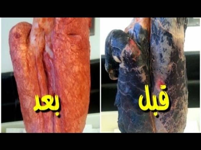 بالفيديو : افضل طريقة للتخلص من النيكوتين بالجسم خلال 72 ساعة