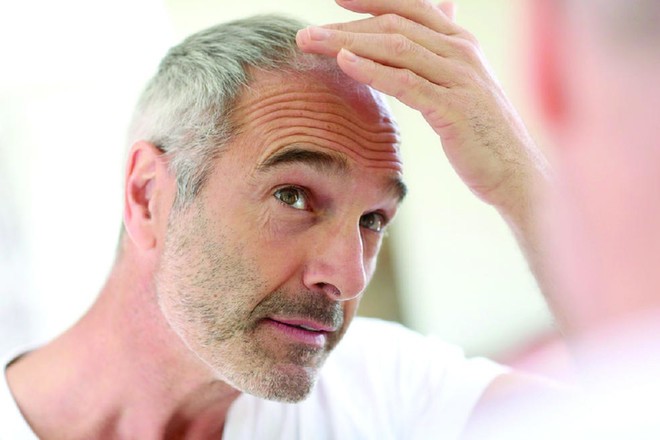 دراسة تحدد "الأسباب الحقيقية" لظهور الشيب